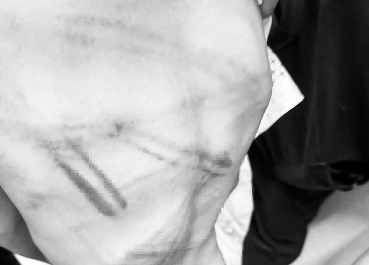 Police are investigating the case of a father beating his child bruised. Photo: Minh Hoa Commune People's Committee