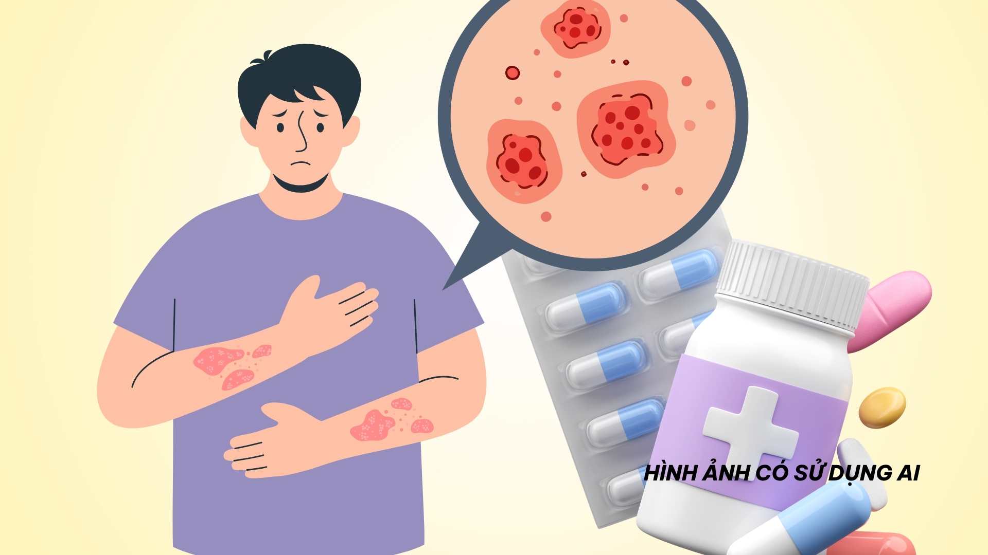 How to use medicine to treat pain after herpes zoster safely and effectively