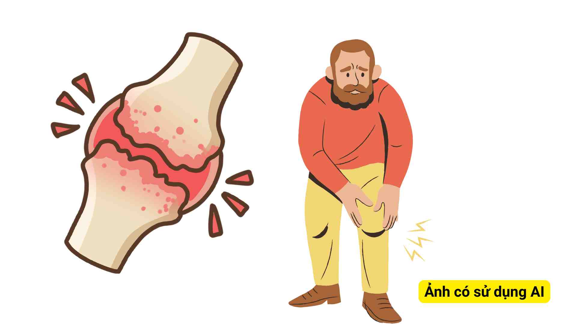 According to experts, osteoarthritis is the most common cause of knee joint pain in the elderly. Graphic photo: Huong Son/ Photo using AI