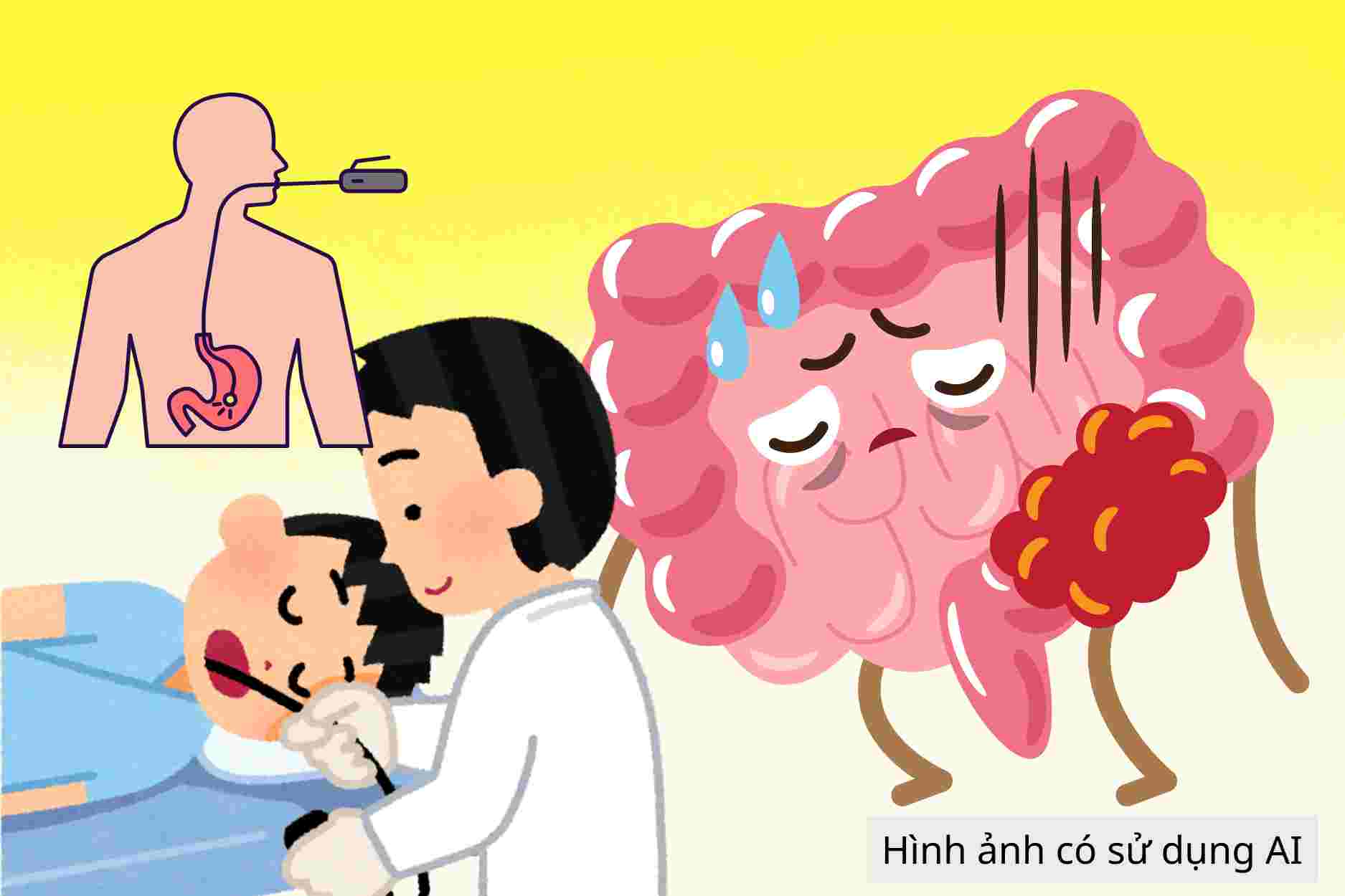 People who should undergo digestive cancer screening