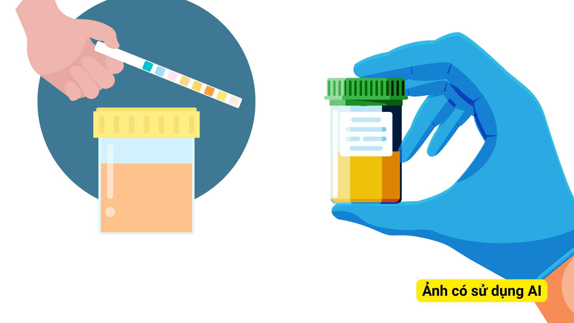 People need to pay attention if urine appears with a lot of small, thick, long-lasting foam and repeats in most urinations, they need to see a doctor early. Graphic photo: Huong Son/ Photo using AI