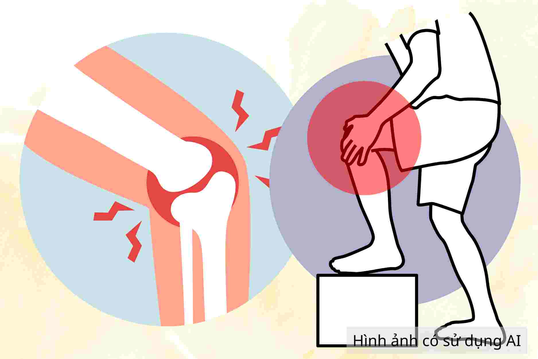 4 ways to reduce knee joint discharge at home to help reduce swelling and pain effectively