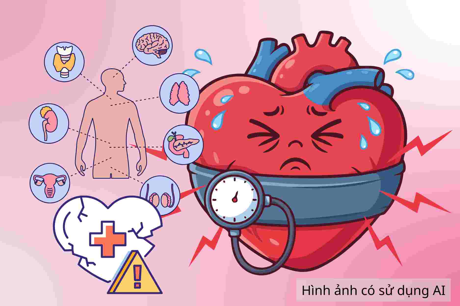 Hypertension artérielle due à une maladie endocrinienne, un facteur facilement négligé