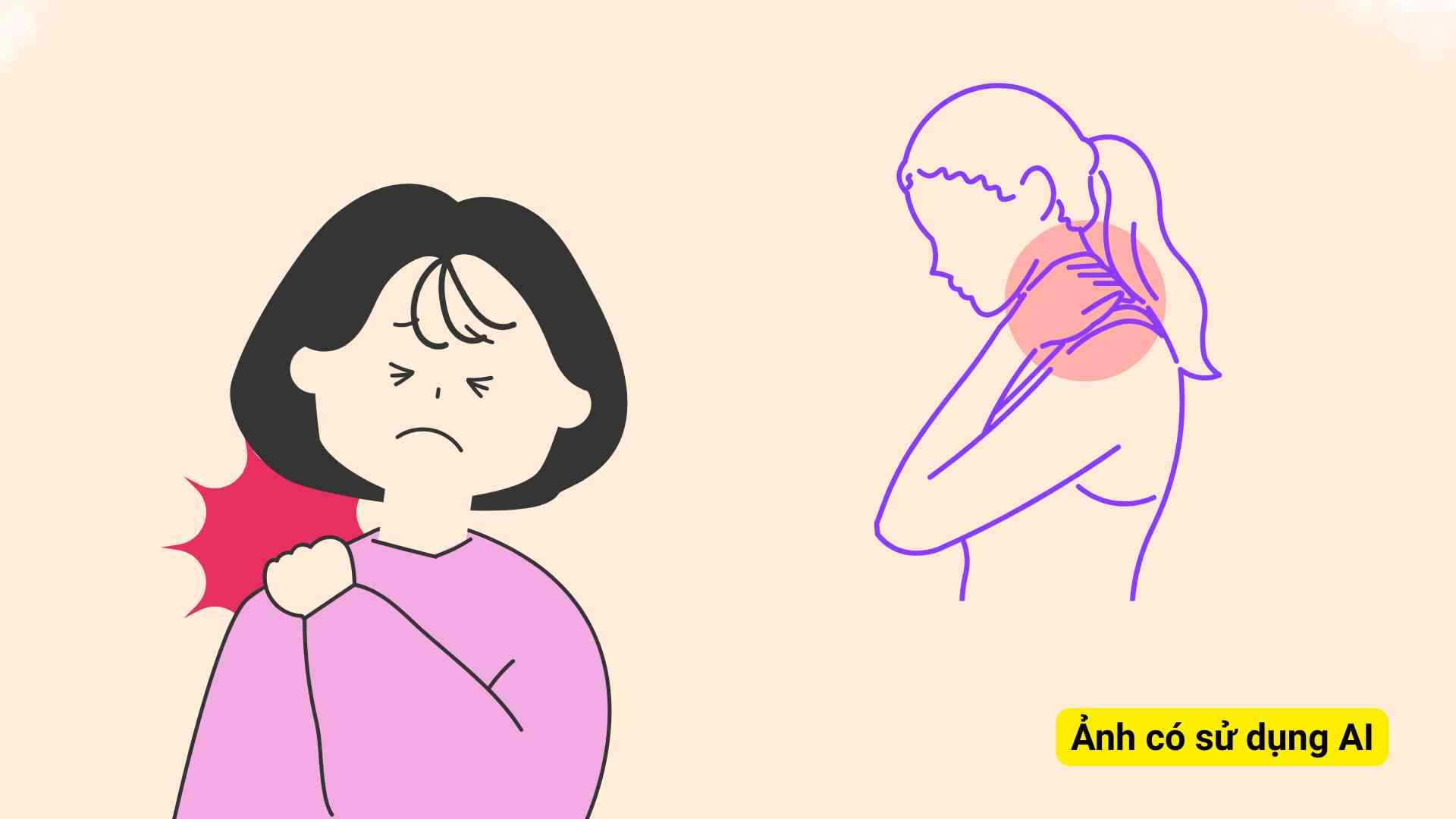 Neck and shoulder pain requires gentle exercise to help relax the muscles in the neck area. Graphic photo: Huong Son/ Photo using AI