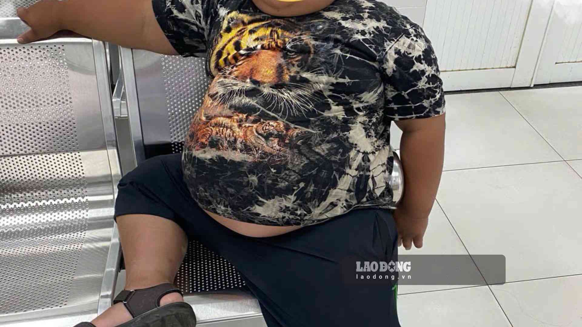 Doctors warn that obesity in children is increasing rapidly. Photo: Nguyen Ly