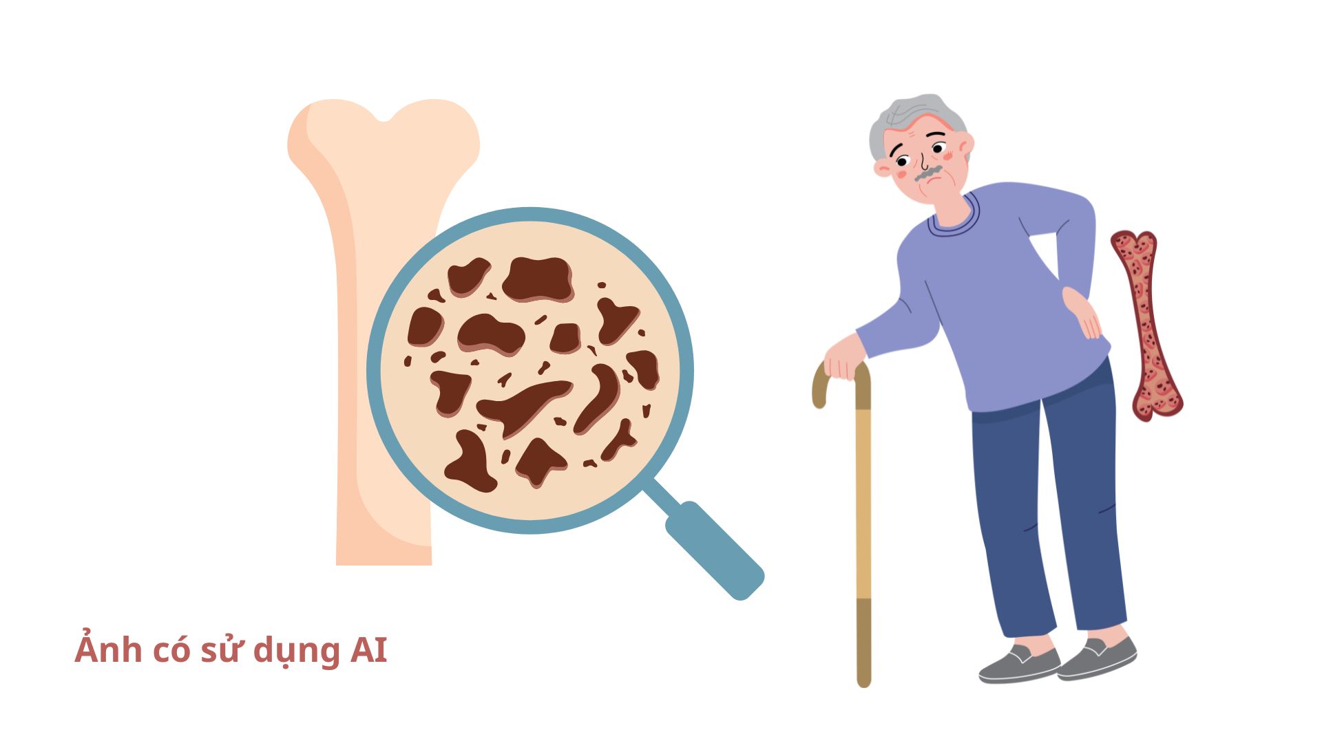 Studies show that men with fractures due to osteoporosis have a higher risk of death than women. Photos using AI: Huong Son