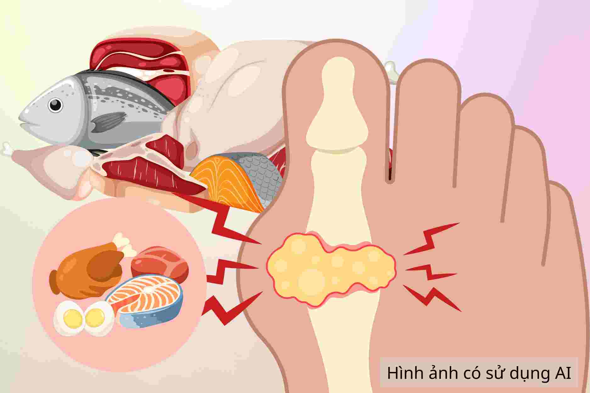How do gout patients eat meat to avoid increasing uric acid.