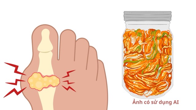 Traditional fermented vegetables have the ability to support controlling increased uric acid. Photo using AI: Huong Son
