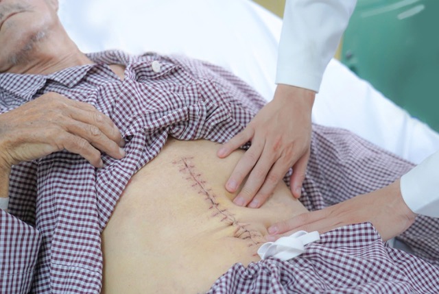 The patient was successfully operated on by doctors. Photo: BVCC