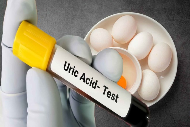 People with high uric acid can eat eggs. Graphics: Ha May