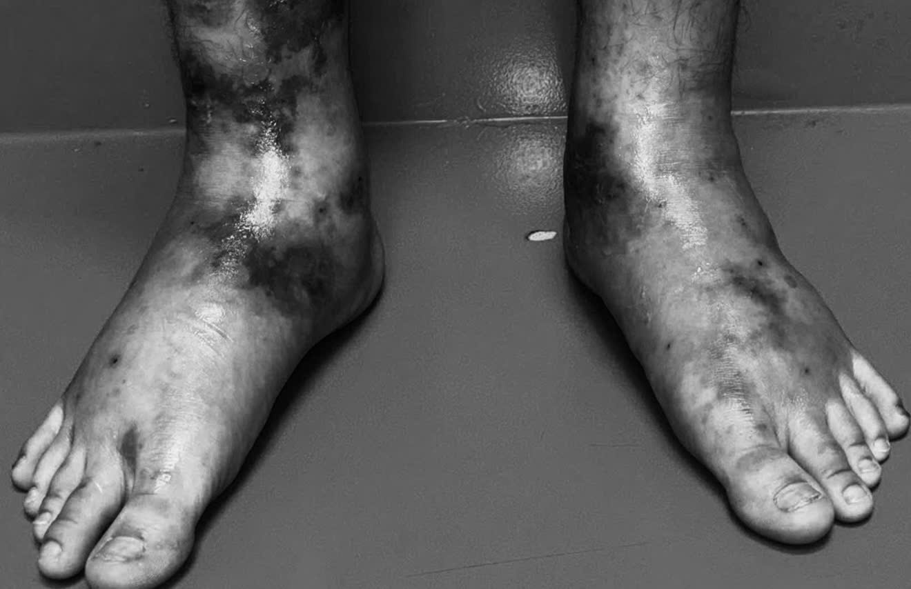 Patients with rare diseases are detected from skin lesions. Photo: Provided by the National Hospital of Dermatology