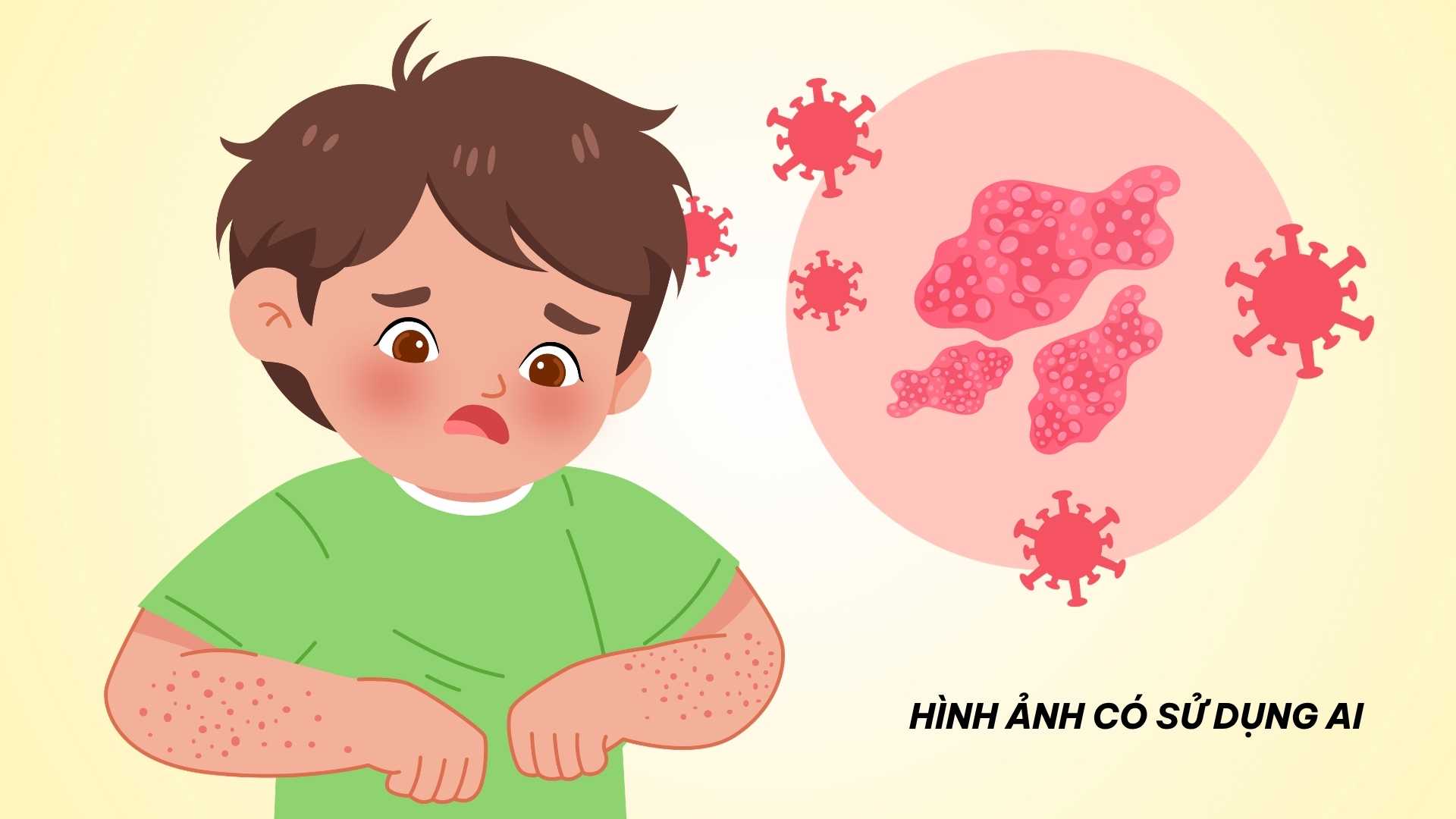 Signs to recognize staph infection that parents should not ignore