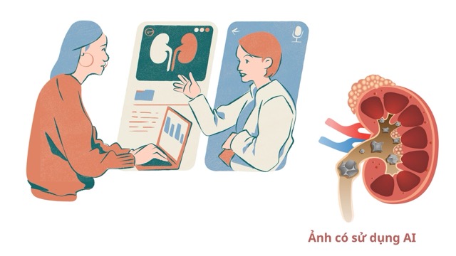 Los casos de cálculos pequeños, ubicados en el podio renal y que no causan obstrucción, infección... pueden ser monitoreados periódicamente, sin necesidad de cirugía. Foto con uso de IA: Huong Son