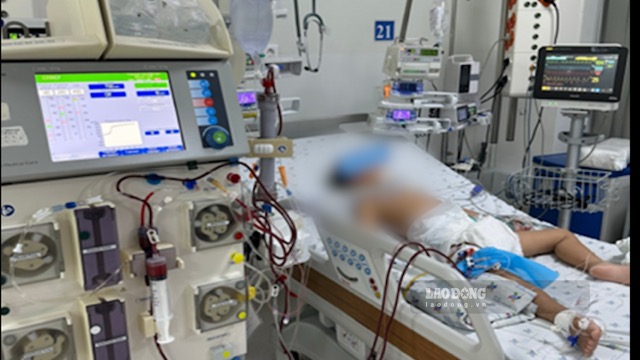 An intoxicated child was successfully saved by doctors thanks to technique or plasma. Photo: Source: City Children's Hospital