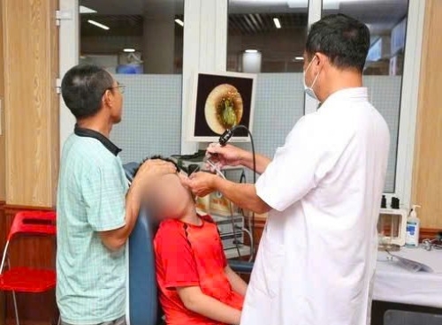 Health check-ups at school help promptly detect foreign objects in students' ears. Photo: Hai Phong Children's Hospital