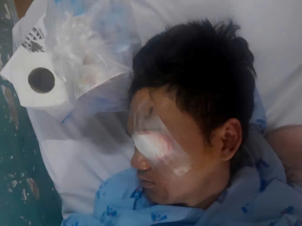 A sudden labor accident occurred, Mr. Huynh Van Tuy lost one eye. Photo: NVCC