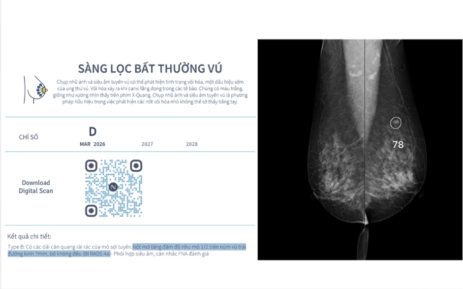 Nếu phát hiện muộn hơn, khối u có thể tiến triển sang giai đoạn muộn, gây khó khăn trong việc điều trị. Ảnh: Nura