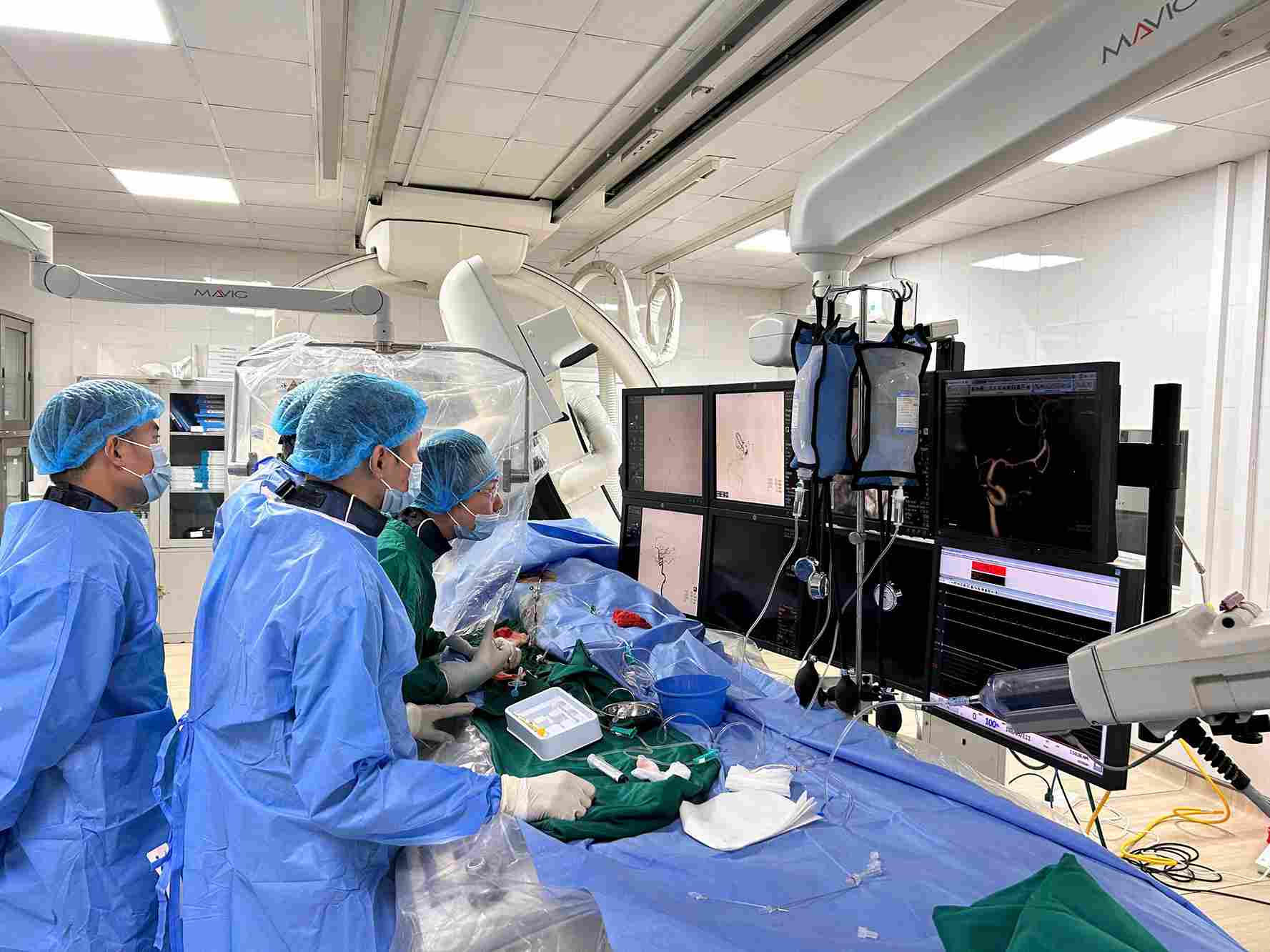 Suffering from headaches for many months, a woman discovered a brain artery aneurysm larger than 5 mm. Photo: BVCC