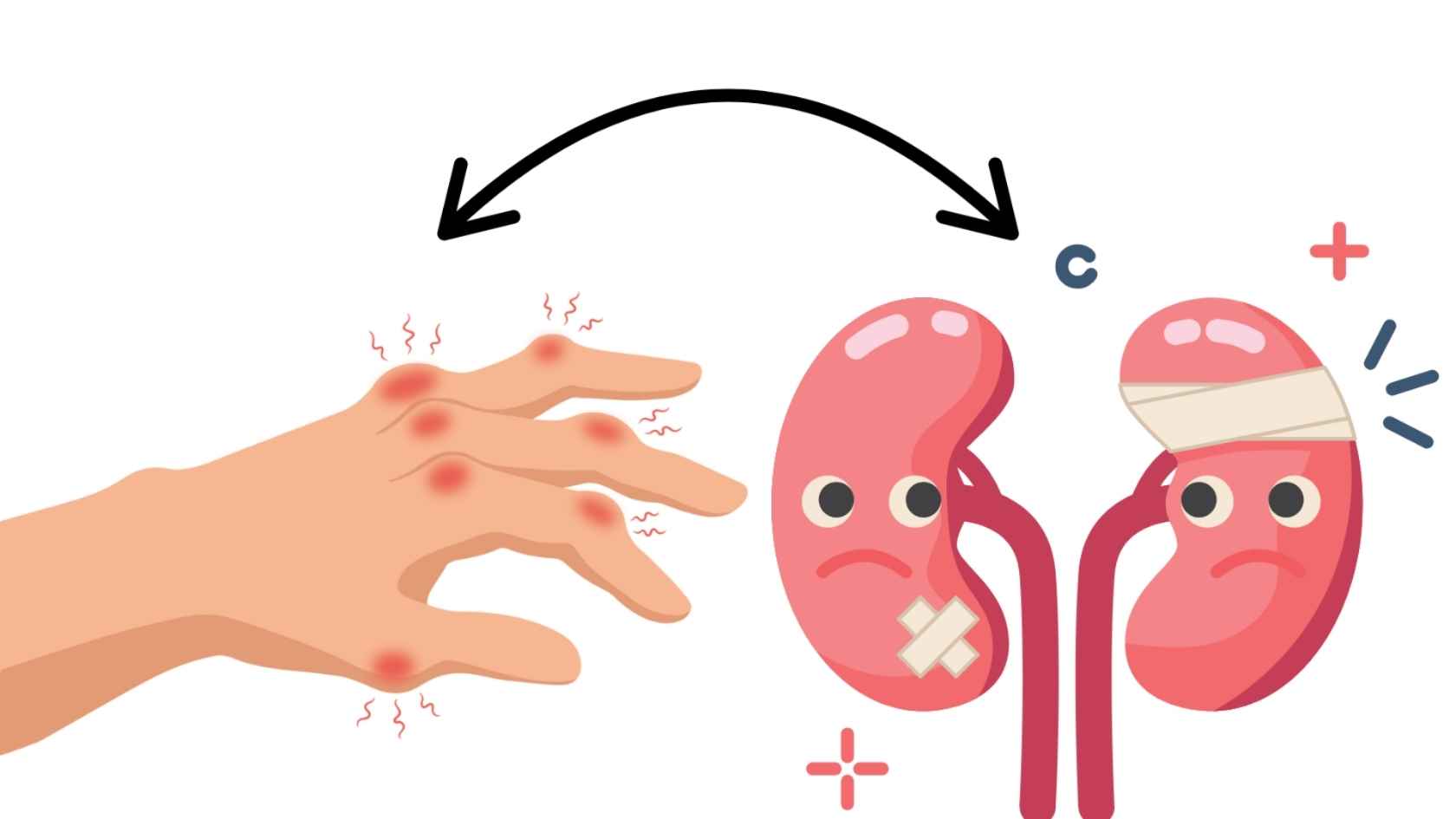 High blood uric acid can silently cause kidney damage. Graphics: Ha May/Source Canva