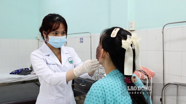 不適切な技術で美容施術を受けた際に顔面合併症を起こした患者。写真:グエン・リー
