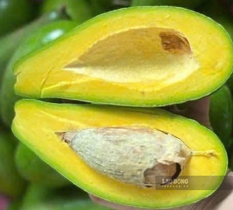 Avocado is considered one of the natural magnesium supplementation options if you don't like to eat bananas. Photo: Kieu Vu