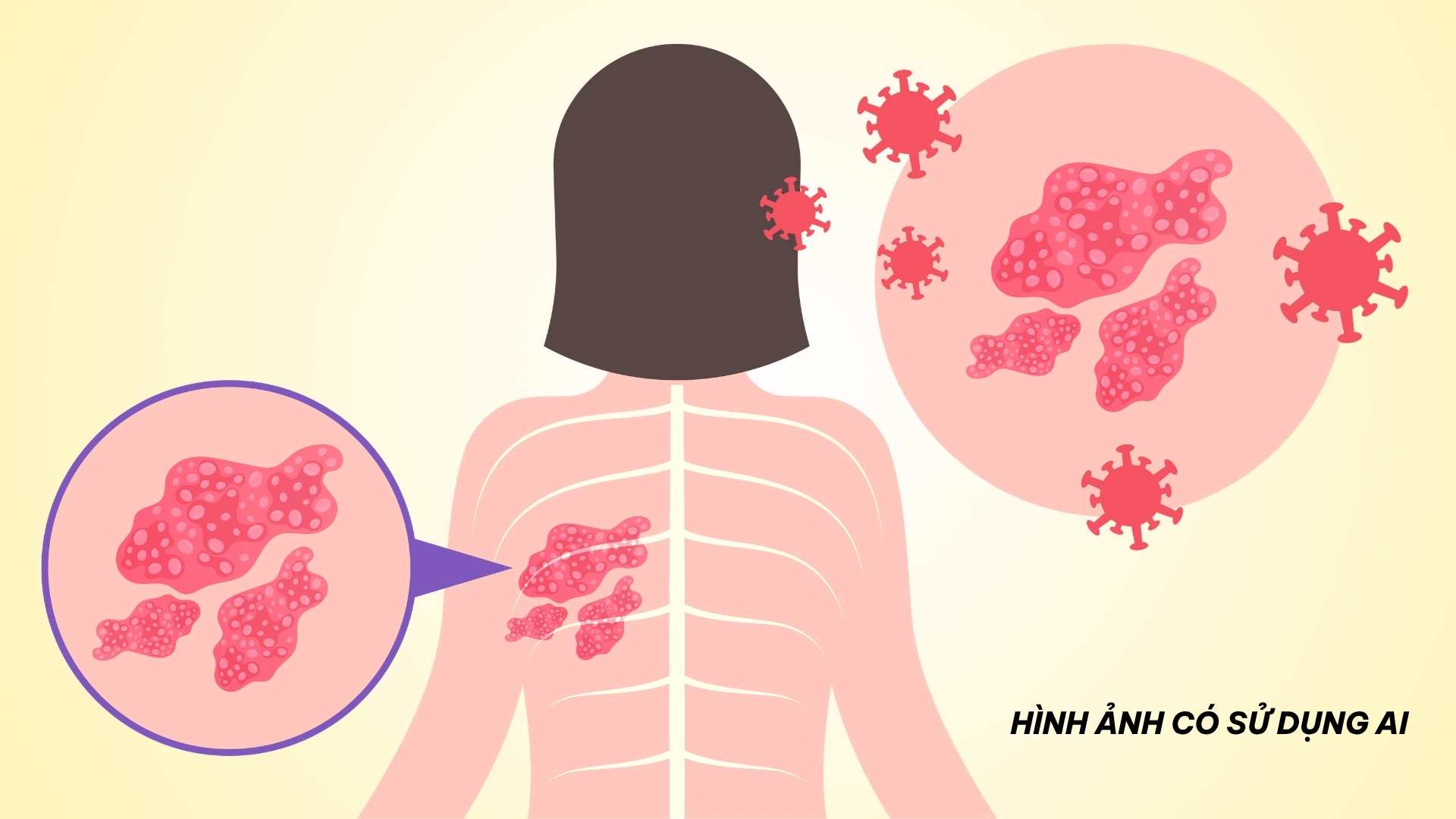 Signs to recognize shingles that should not be ignored