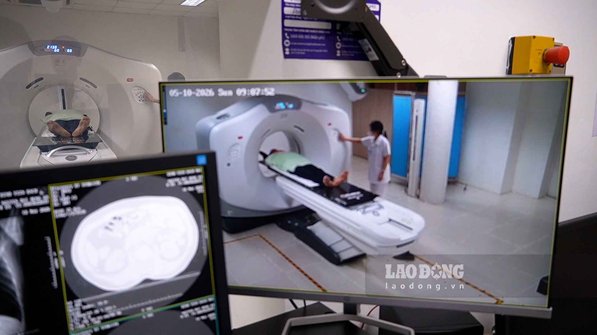 El costo de la tomografía PET/CT es de 20-25 millones de VND, los pacientes esperan recibir apoyo del seguro médico.