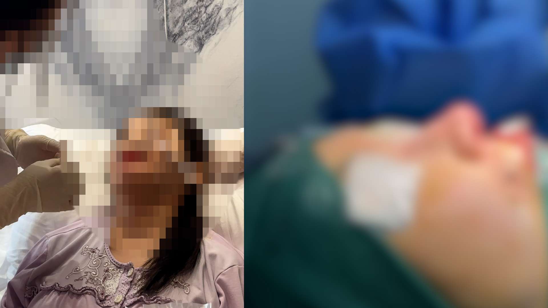 The persistent treatments of Ms. Trang Le after her nose was infected and deformed from cosmetic surgery abroad. Photo: Character provided