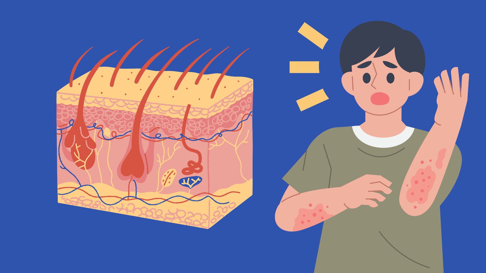 People with severe allergies and widespread skin infections need timely medical treatment. Photos using AI: Huong Son