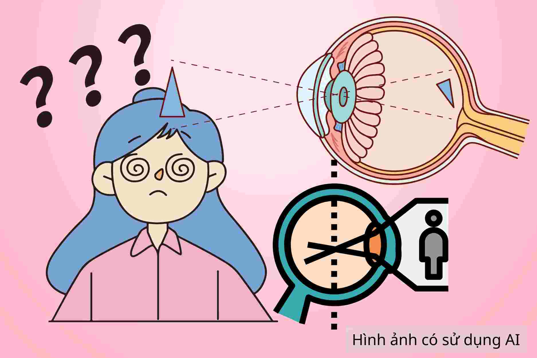 4 groups of people at high risk of astigmatism, need to proactively check their eyes early