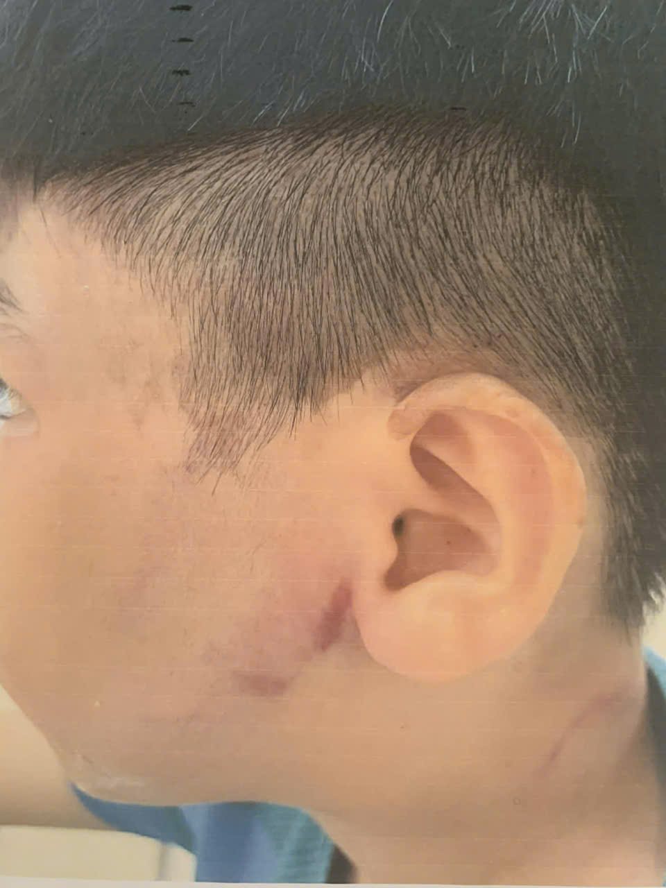 Cháu bé 8 tuổi ở TPHCM nghi bị bạo hành, bà ngoại gửi đơn cầu cứu. Ảnh: Gia đình cung cấp