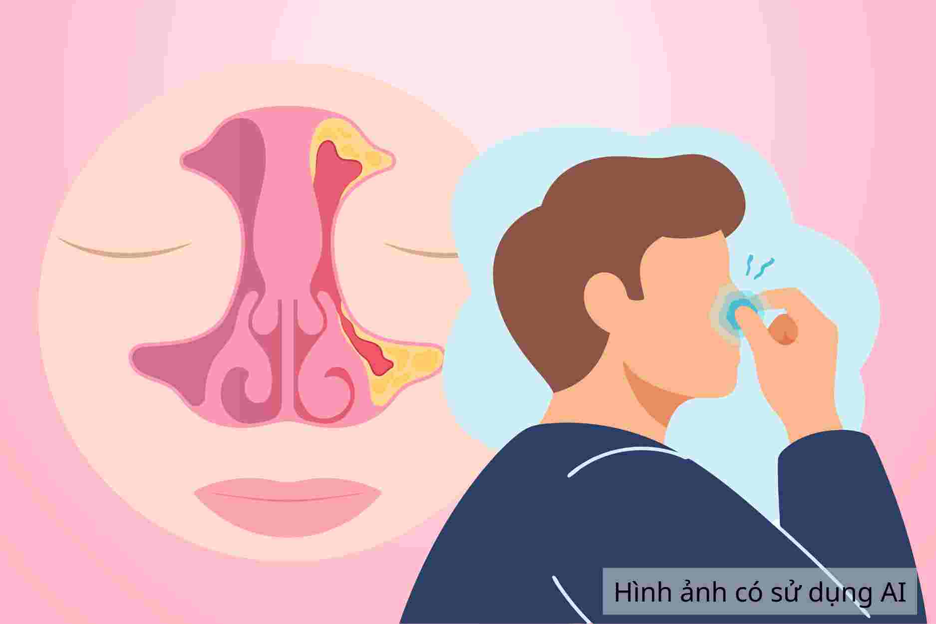Enfermedades de sinusitis que pueden estar relacionadas con ronquidos