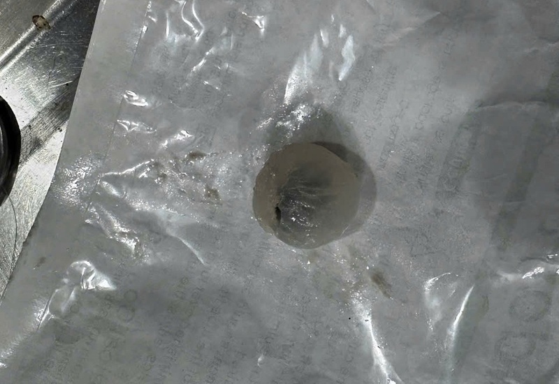 Longan fruit stuck in the trachea caused the patient to die. Photo: Lang Son Provincial General Hospital