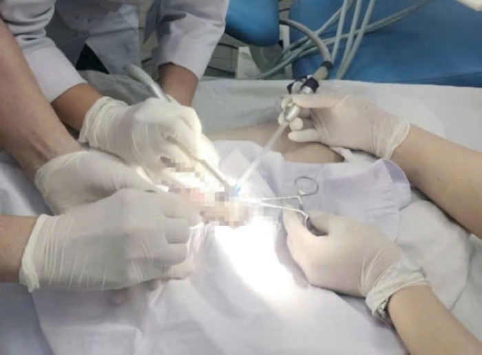 Rescuing a young man who encountered a rare incident with an iron bayonet in Tay Ninh. Photo: Long An General Hospital