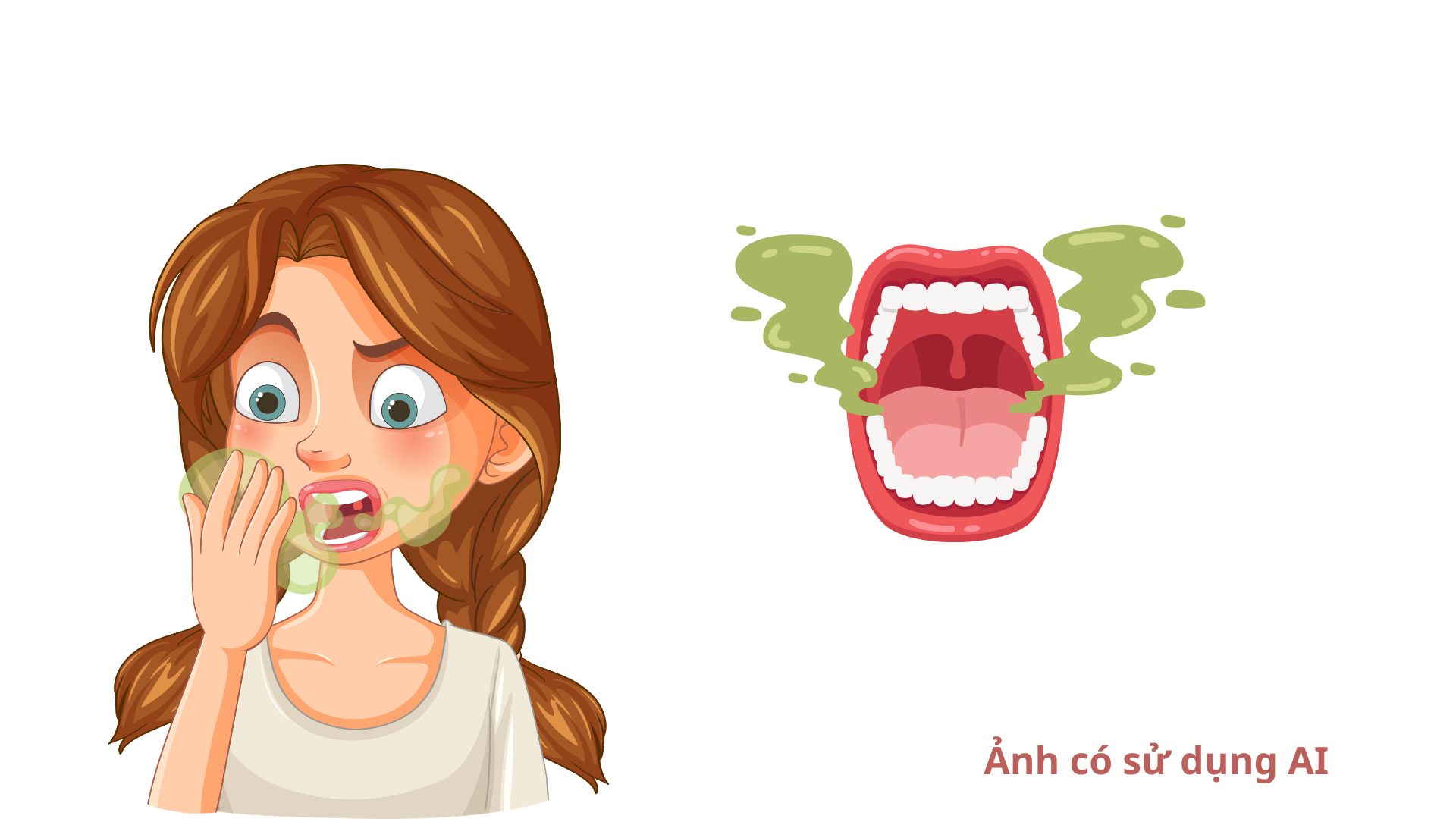 Bad breath often originates from local causes such as plaque on the tongue, periodontitis. Photos using AI: Huong Son