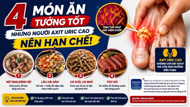 Uric acid is the final product of the purine metabolism in the body. When more uric acid is produced than the ability to excrete, this concentration can increase in the blood. Image using AI: Huong Son