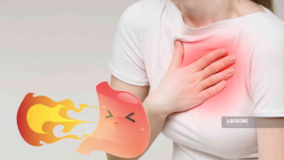 Nighttime gastroesophageal reflux can make it difficult for patients to sleep, wake up many times and have long-term effects on health. Graphics: Nguyen Ly