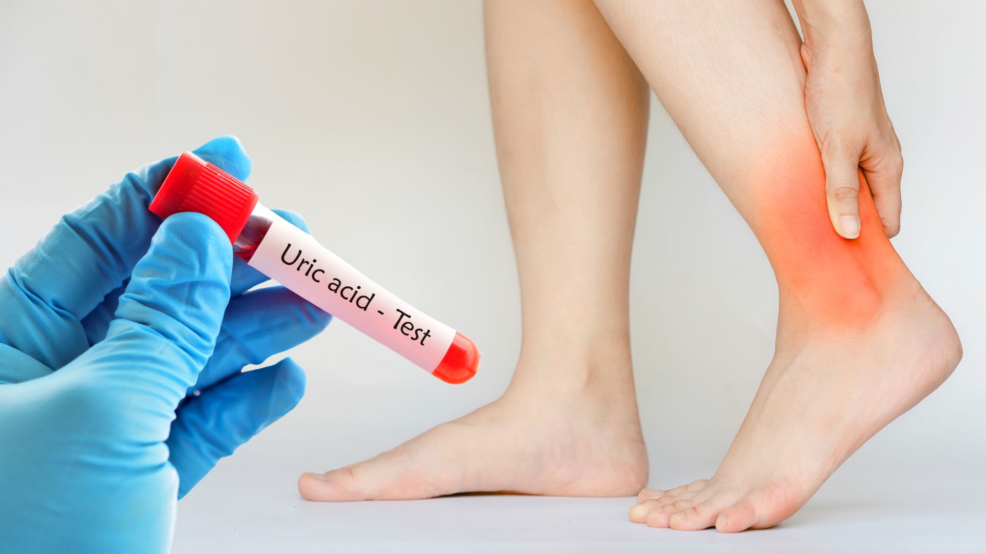 Abnormal changes on the skin and soft tissues may be a warning sign of increased uric acid. Graphics: Canva