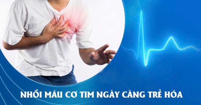 Bác sĩ cảnh báo về ca nhồi máu cơ tim ở bệnh nhân 22 tuổi