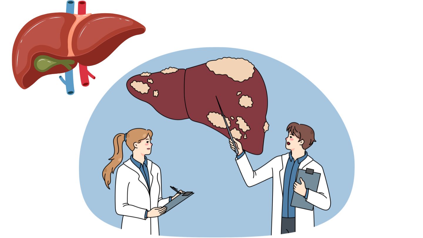 Uno de los signos comunes cuando la función hepática tiene problemas de fatiga, falta de energía, mala alimentación. Foto gráfica: Huong Son/Con uso de IA