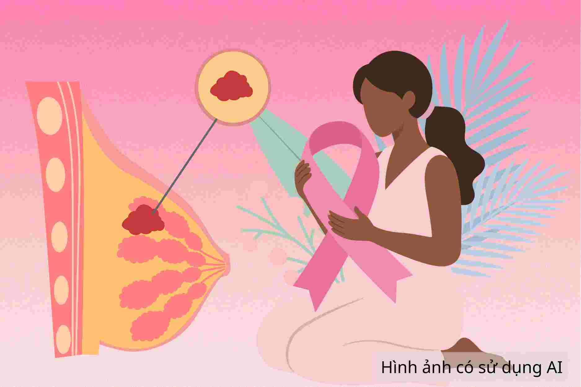 5 groups of women at high risk of breast cancer