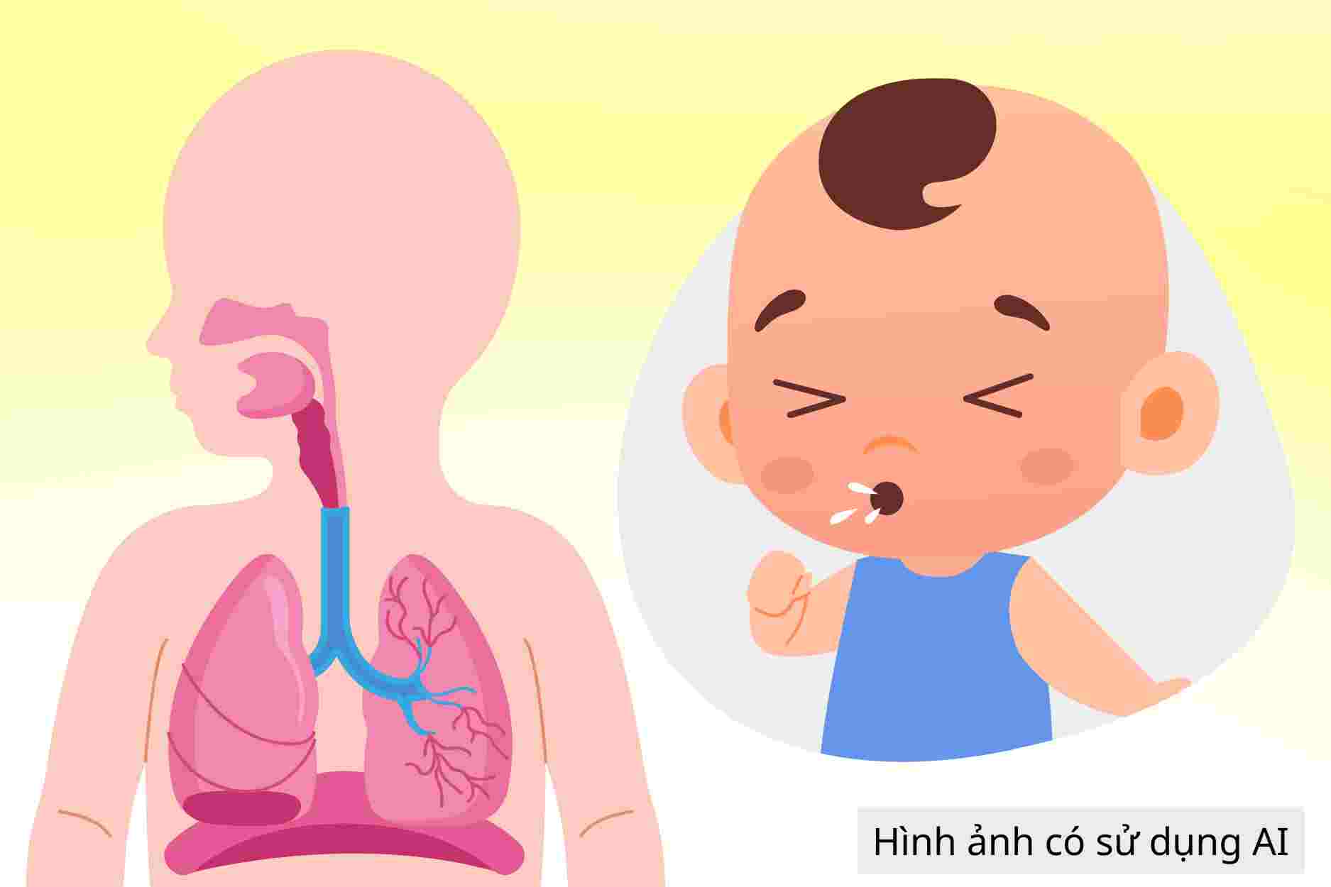 5 mistakes parents can easily make when caring for children's respiratory tract