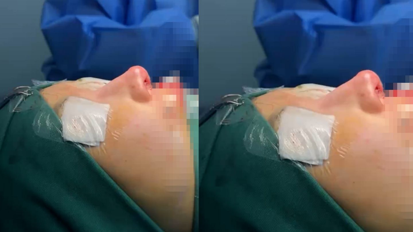 Góc khuất “du lịch thẩm mỹ“: Khách hàng trả giá đắt vì tin vào quảng cáo. Ảnh: Nhân vật cung cấp