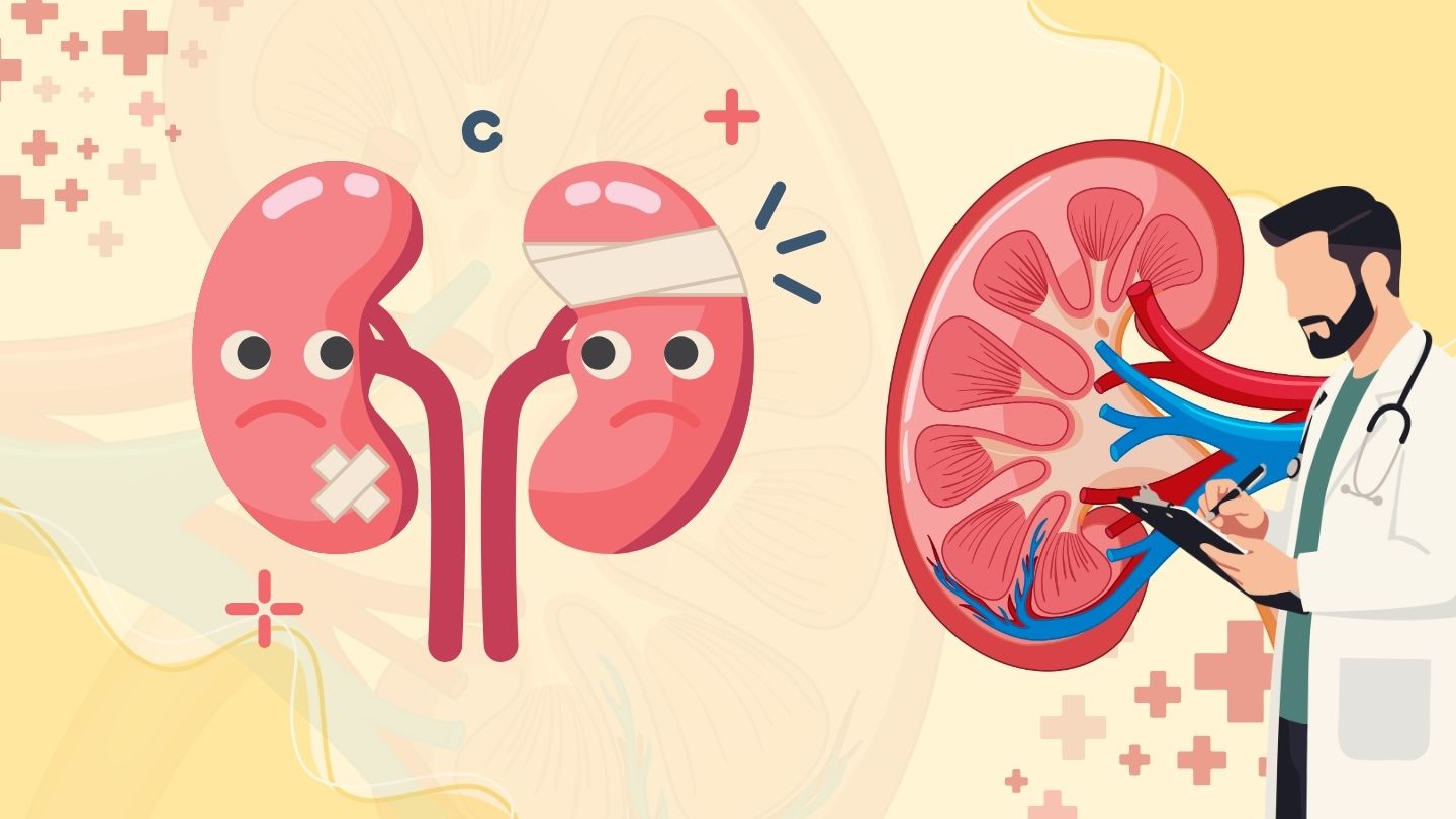 Chronic kidney patients may increase the risk of myocardial infarction and stroke. Graphic photo: Huong Son/Using AI