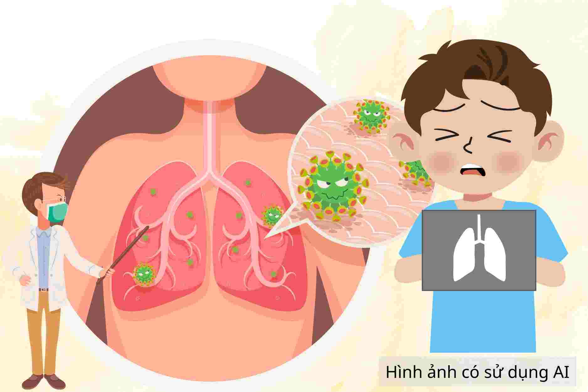 Parents need to know 5 vaccines to help reduce the risk of pneumonia in children