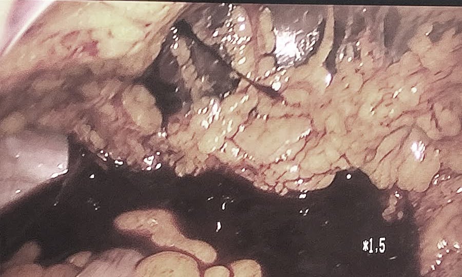 Doctors have just successfully resuscitated a female tourist with a ruptured ovarian cyst. Photo: Hospital 22-12 provided