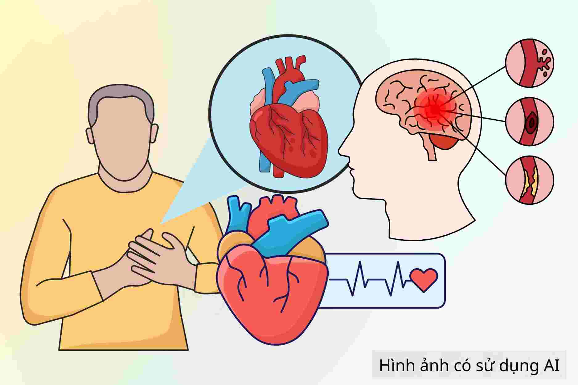 Metabolic factors that increase the risk of cardiovascular disease and stroke