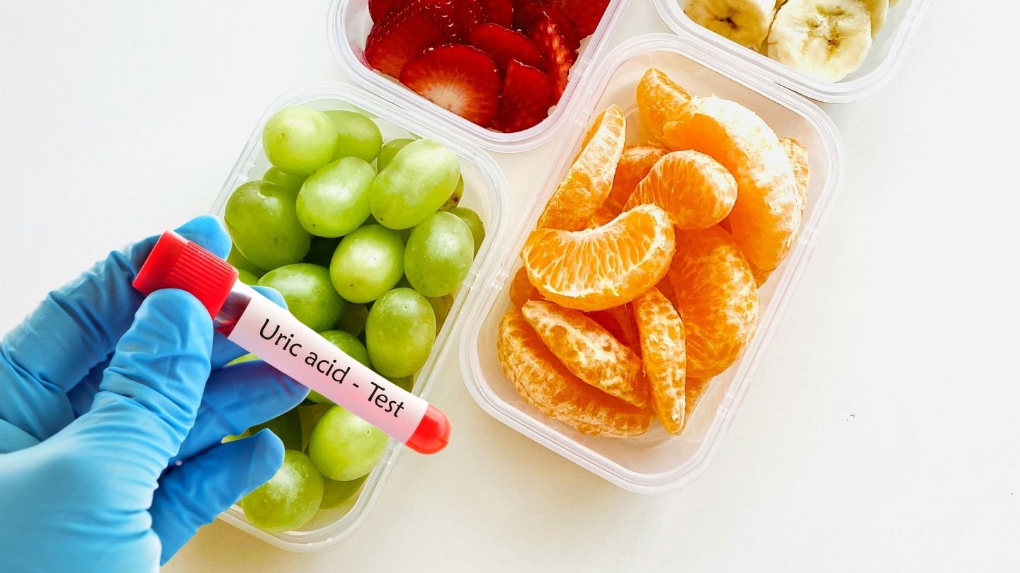 People with high uric acid should eat fruits with low glycemic index. Graphic photo: Huong Son/ AI used