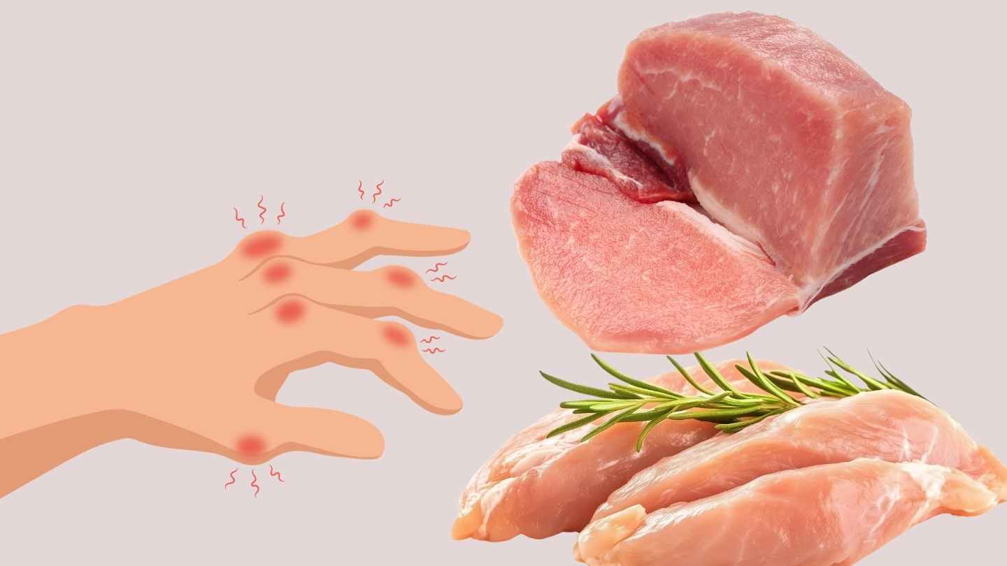 High uric acid does not require completely abstaining from meat, the important thing is to choose the right one. Graphics: Ha May/Source Canva