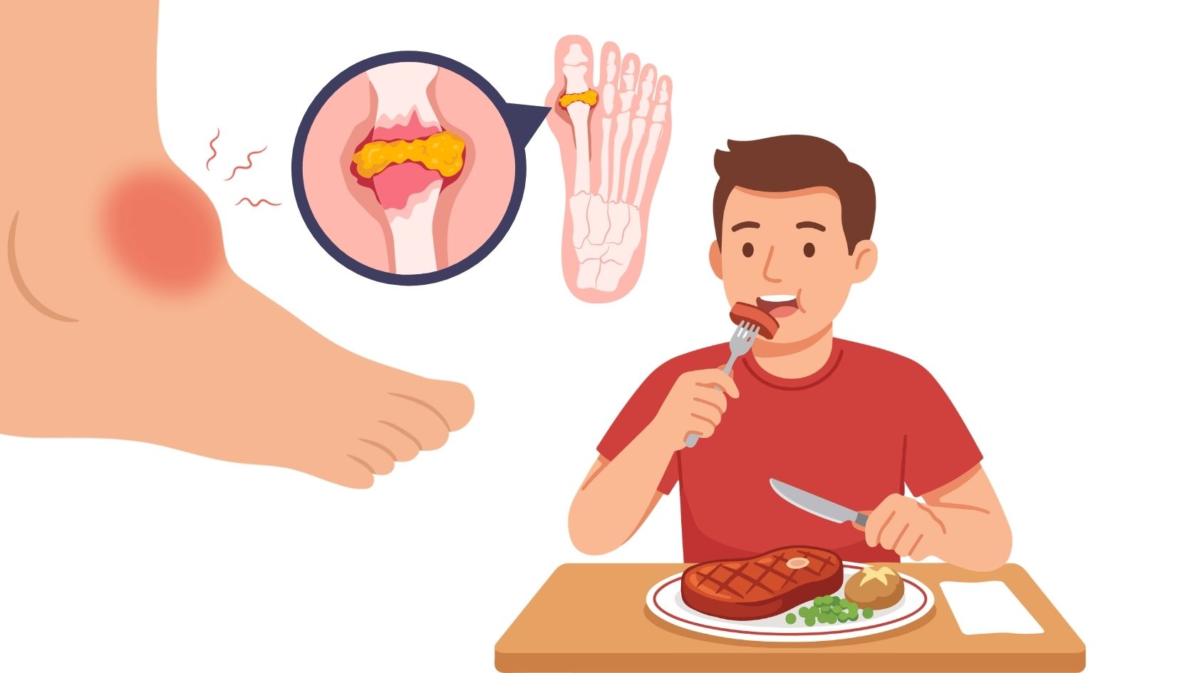 Uric acid control does not depend on how much meat you eat but also relates to the overall diet, weight, water intake... Graphic photo: Huong Son/AI used